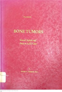 Image of BoneTumors General Aspects And Data On 6.221 Case