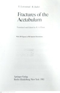 Image of Fractures Of The Acetabulum
