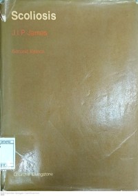 Image of Scoliosis